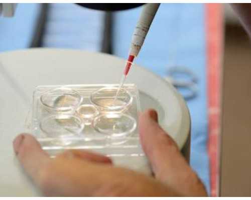 供卵试管怀孕,试管婴儿怀孕后是选择阴超还是B超?10够用不!