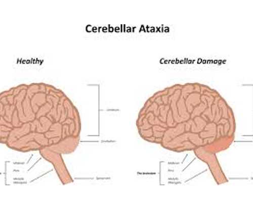 青岛代孕产子机构,35岁弱精、少精在青岛妇女儿童医院做供精试管费用是多少