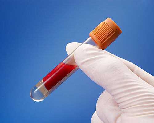 青岛哪家医院可以检查男性不育?检查费用大概要多少钱?