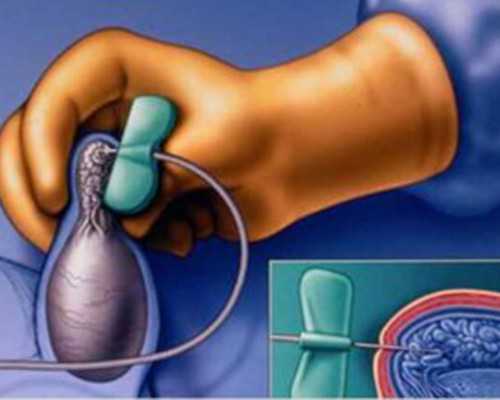 代生子多少钱,孕酮低于15的危害有哪些,如何提高孕酮水平保胎