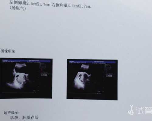 2026青岛农村给孩子加急迁移户口一天能办理完手续吗?