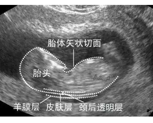 青岛哪里代孕便宜,试管做男孩价格便宜吗?国内医院可以做吗?_青岛地区货拉