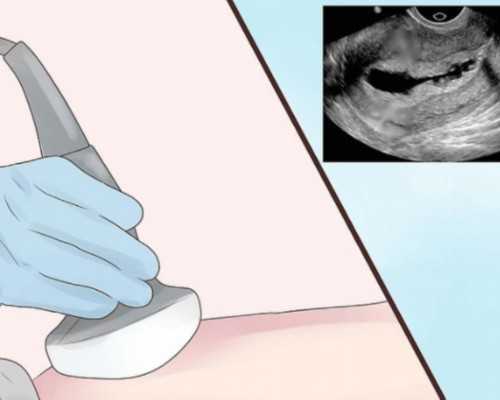 权威怀孕机构,子宫内膜厚14mm怎么办