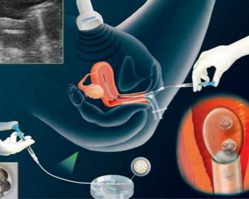 青岛第三代试管代孕可以包成功吗,首例中国试管婴儿年过30，你了解试管婴儿吗