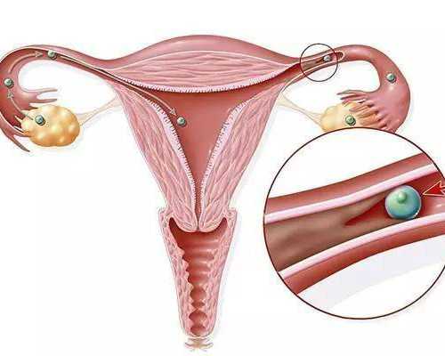 数十万的确诊，敢于说真话的城市，青岛正面临疫情冲击