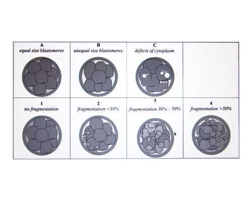 优选低风险糖尿病试管婴儿在青岛诞生，试管婴儿技术的发展历史你了解吗？