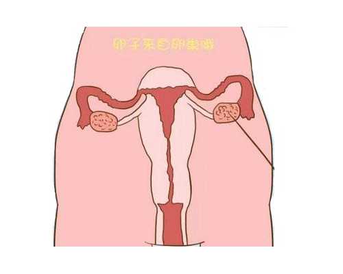 代怀包男孩~女性排卵障碍会出现月经不调的症状吗？