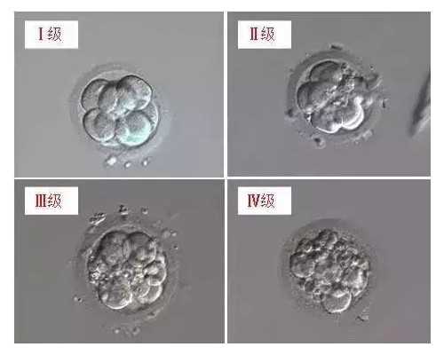 自然流产后怀孕容易吗