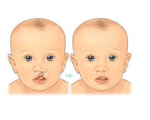 备孕饮食指南：宝宝的成长关键、优质食谱分享与饮食误区