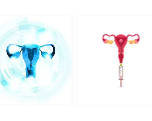 昆明做试管婴儿需要多少钱啊