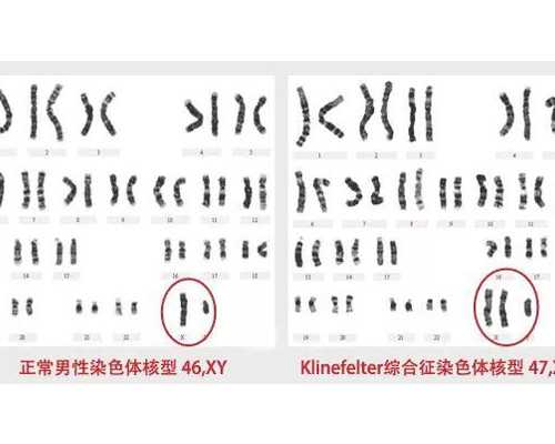 青岛代孕机构安全性高吗,青岛试管 多囊卵巢应该多吃什么？你需要知道这些饮